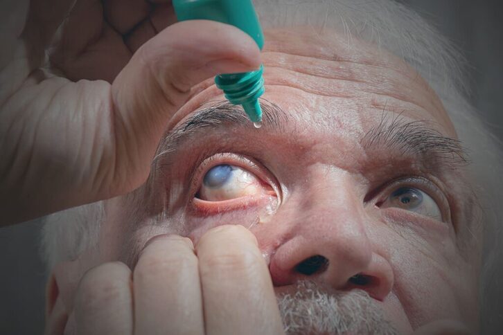 Tantak ohiko tratamendua dira glaukoma kasuetan